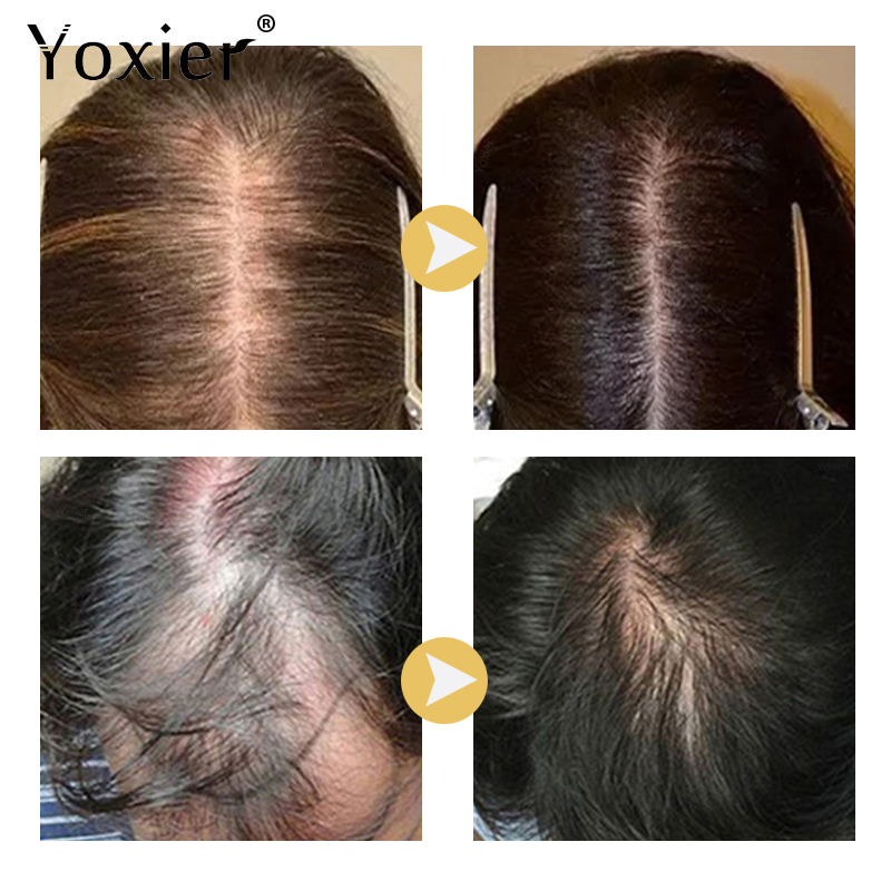 Intensywne Serum wzrostu zapob – Hair Care Hair Serum recenzja i cena